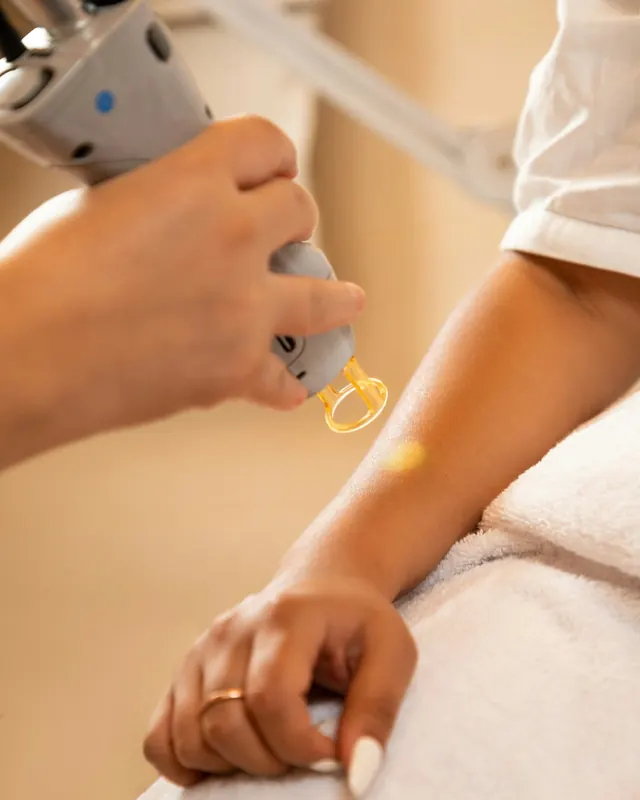 Aparelho de laser aplicado no braço.